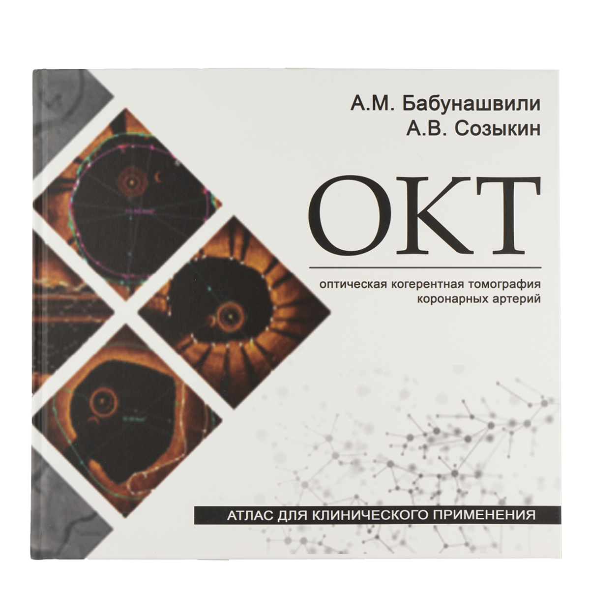 Оптическая когерентная томография коронарных артерий. Атлас для клинического примерения